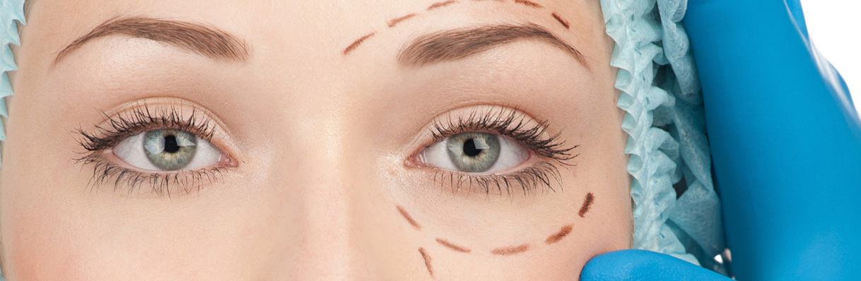 Blefaroplastia